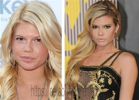 chanel west coast plastic surgery|The Stunning Transformation Of Chanel West Coast .